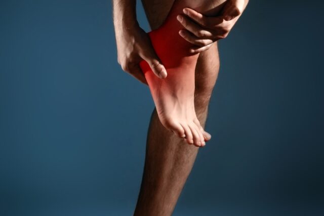 Heel pain, plantar fasciitis, heel spurs